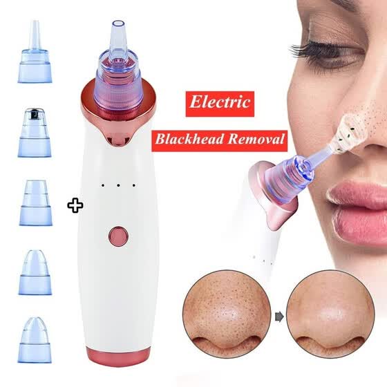 professional blackhead removal
