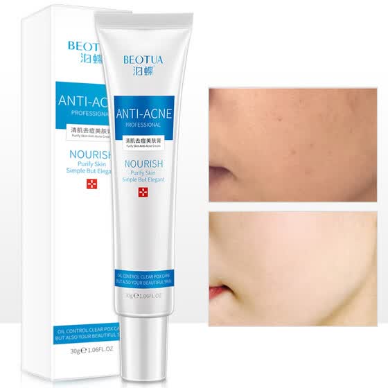 best cream for acne scars and pores