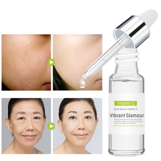 the original acne serum