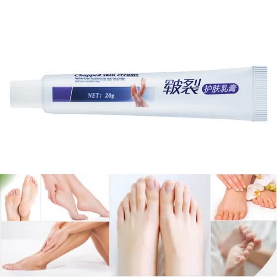 foot crack best ointment