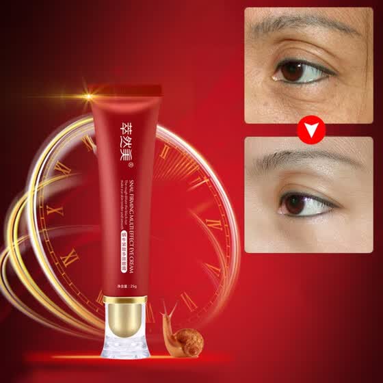 best eye drops for dark circles