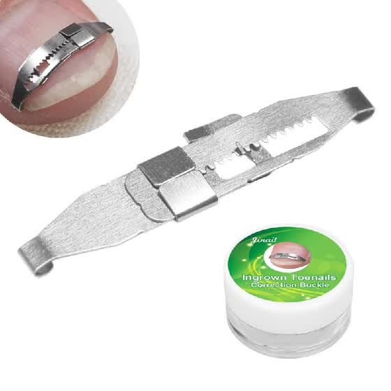 Shop Ingrown Toenail Corrector Toenail Correction Treatment Tool