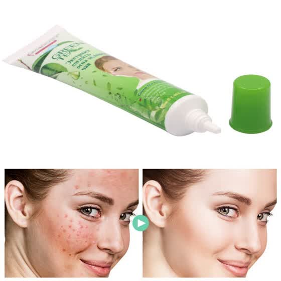 best cream for acne scars and pores