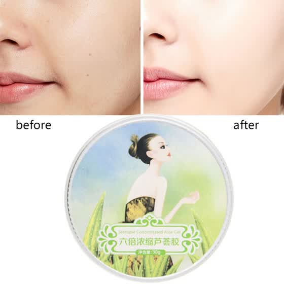 sunscreen anti acne