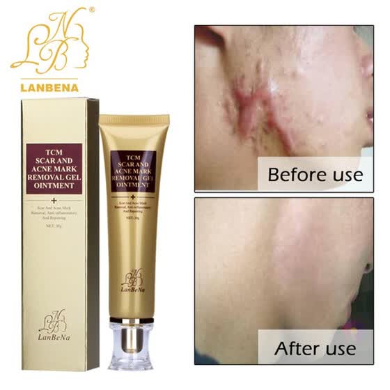 scar lightening cream for black skin